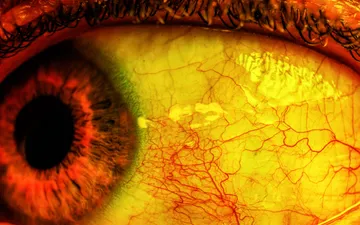El Horror - Primer plano macro extremo de un ojo humano con tonos amarillos y rojizos muy saturados, mostrando en detalle los vasos sanguíneos para generar una atmósfera de terror.